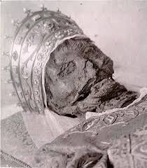 Dettaglio del volto mummificato di Santa Lucia prima del 1955, cavità orbitali con membrane palpebrali essiccate visibili